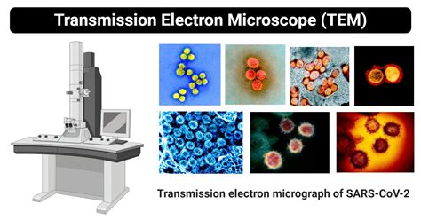 transmission electron microscopy .
